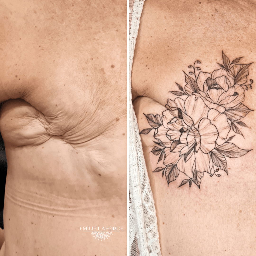tatouage cicatrice villeneuve-les-beziers