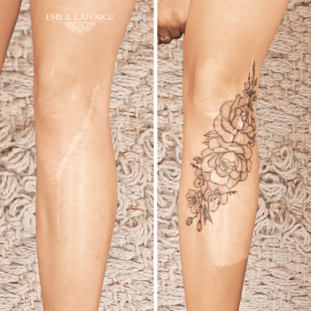 tatouage cicatrice villeneuve-les-beziers