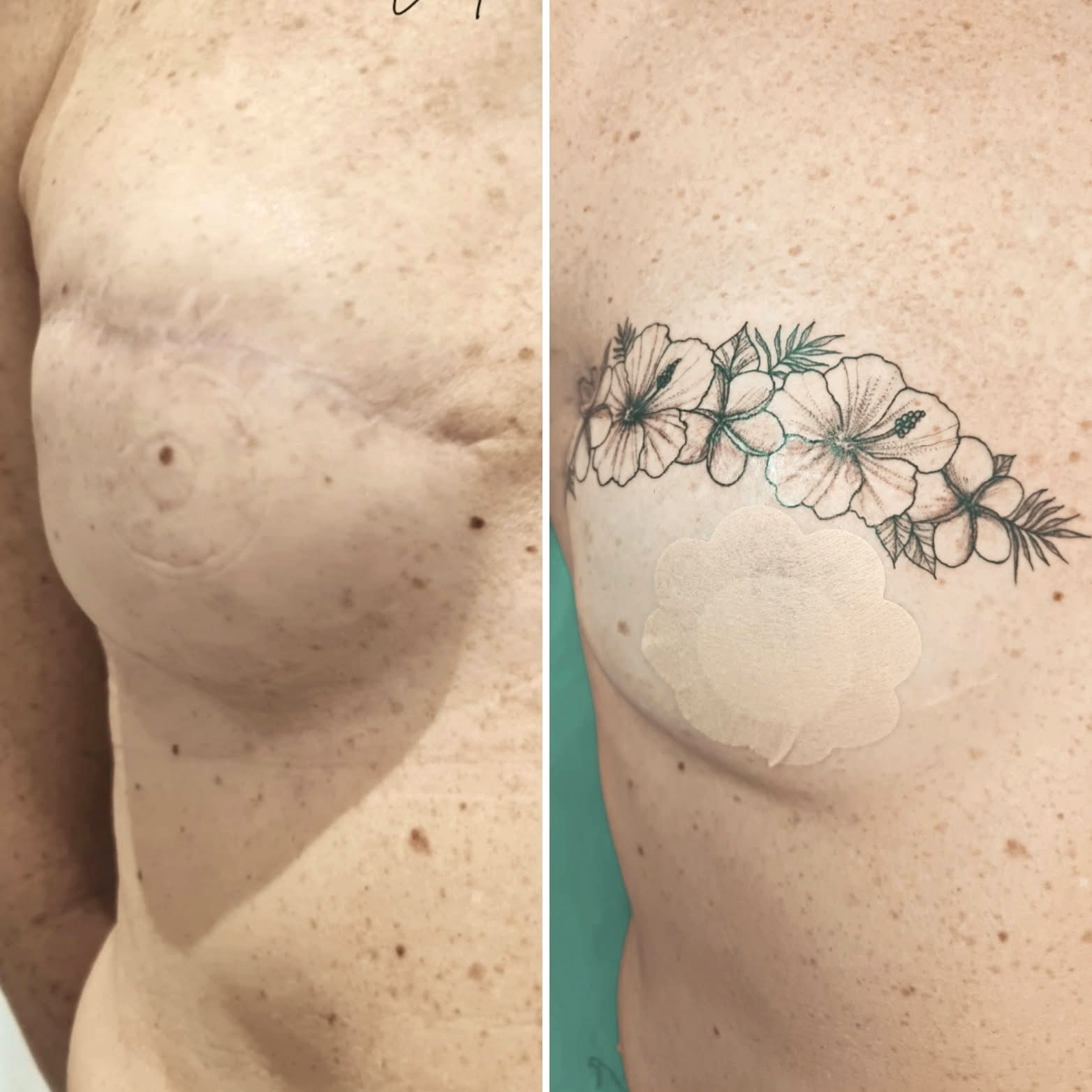 tatouage brulure herault tatouage brulure herault
