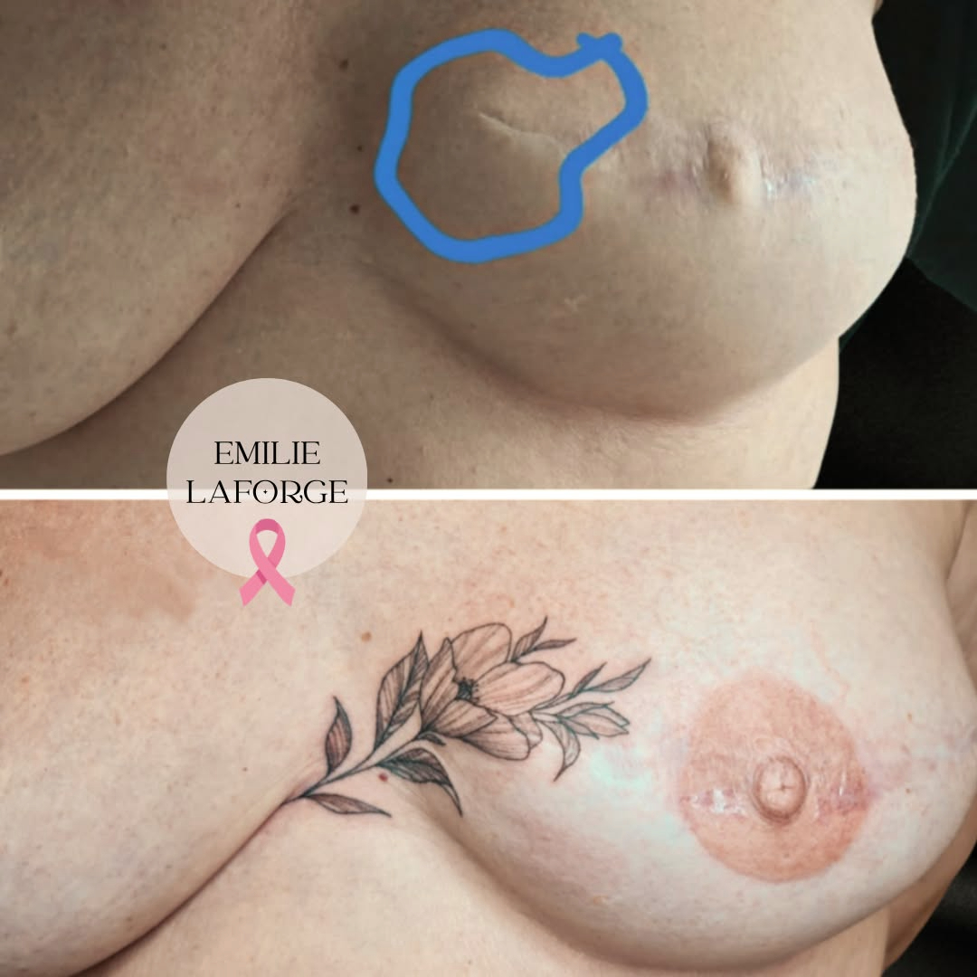tatouage cancer du sein villeneuve-les-beziers