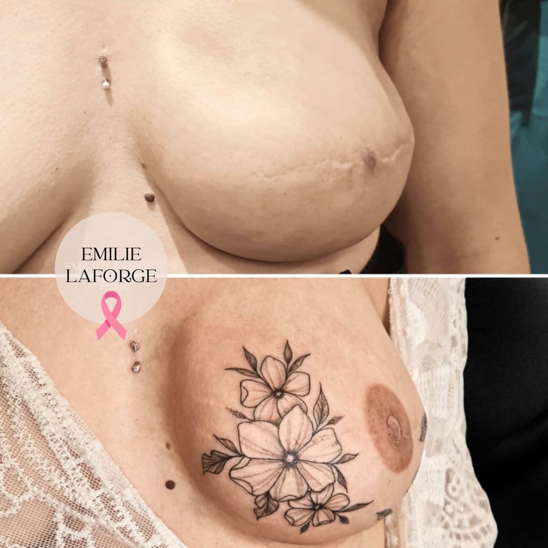 tatouage areolaire beziers