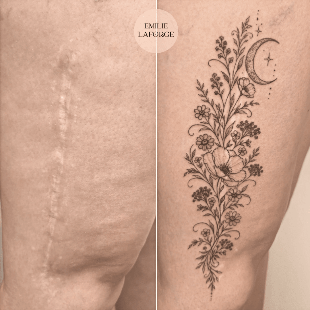 tatouage sur cicatrice hérault tatouage sur cicatrice hérault