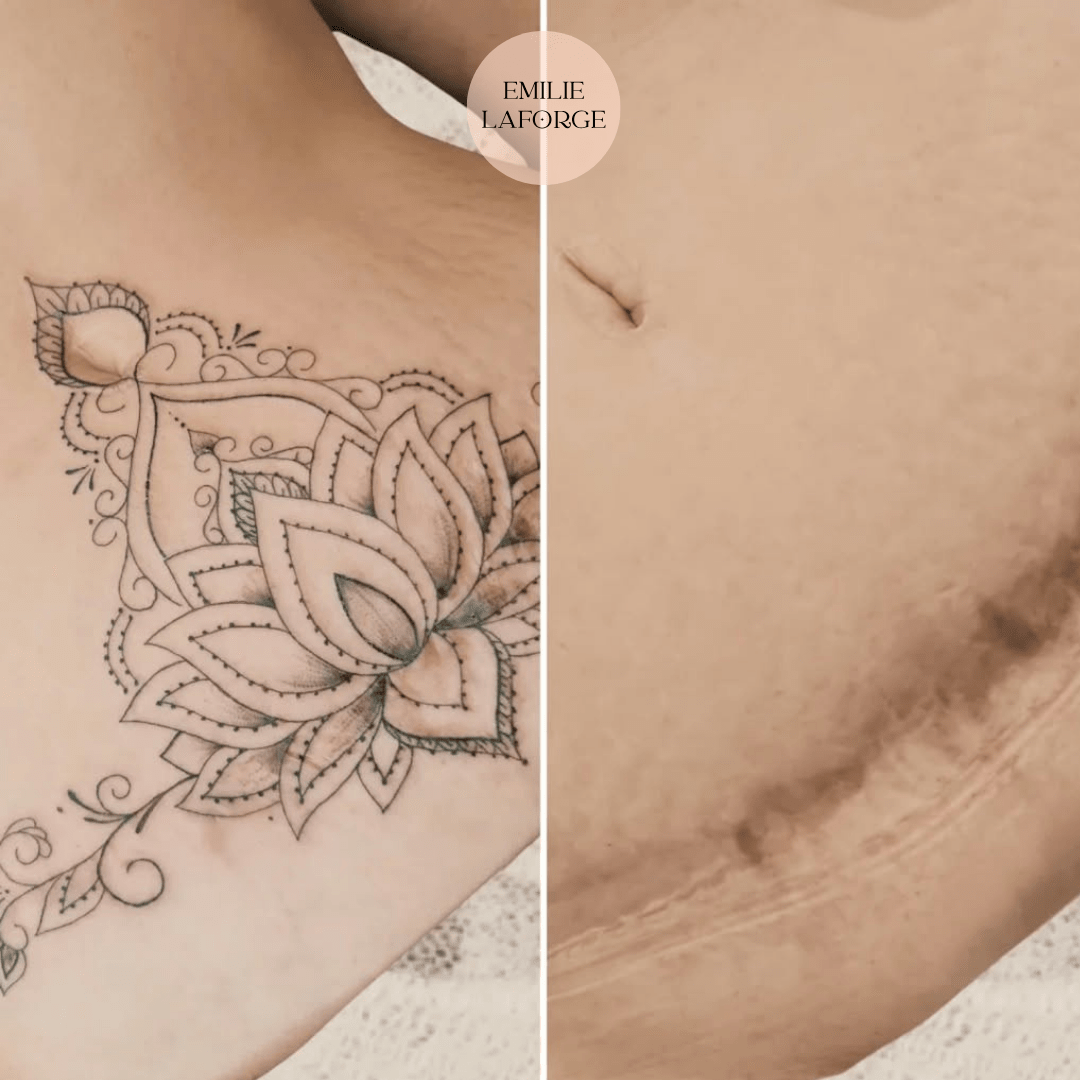 tatouage mastectomie pres de beziers tatouage mastectomie pres de beziers