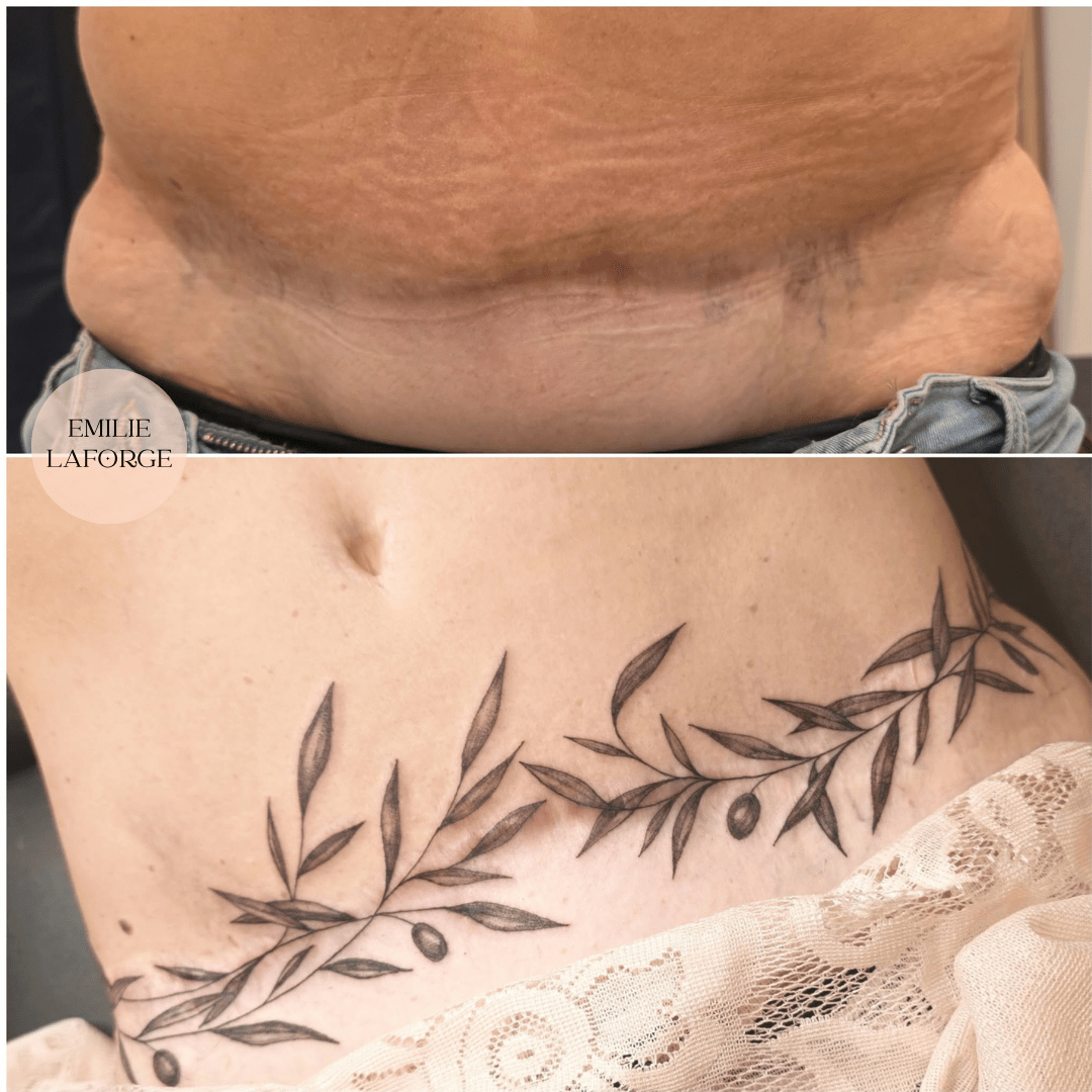 tatouage sur cicatrice hérault tatouage sur cicatrice hérault