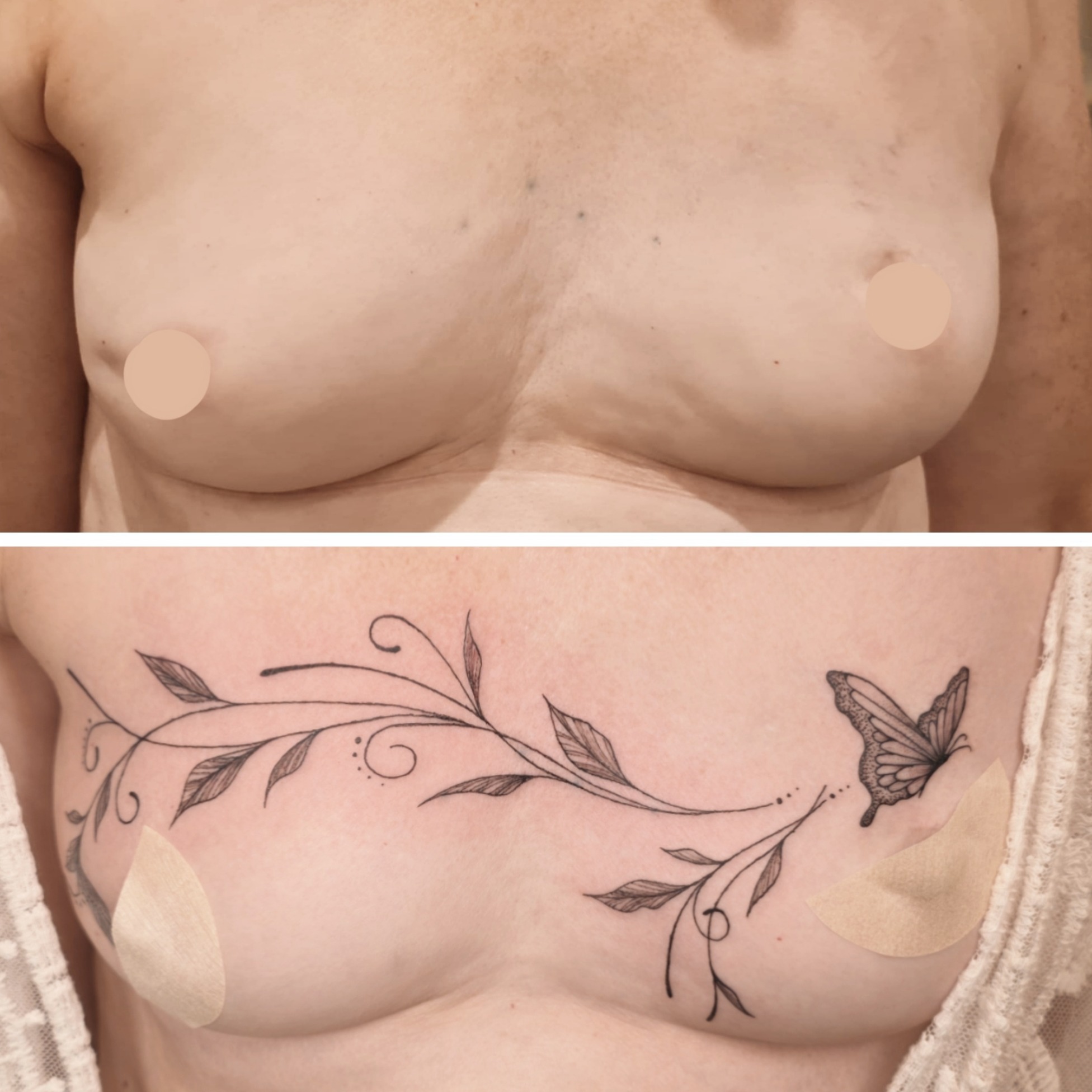 tatouage cancer du sein herault