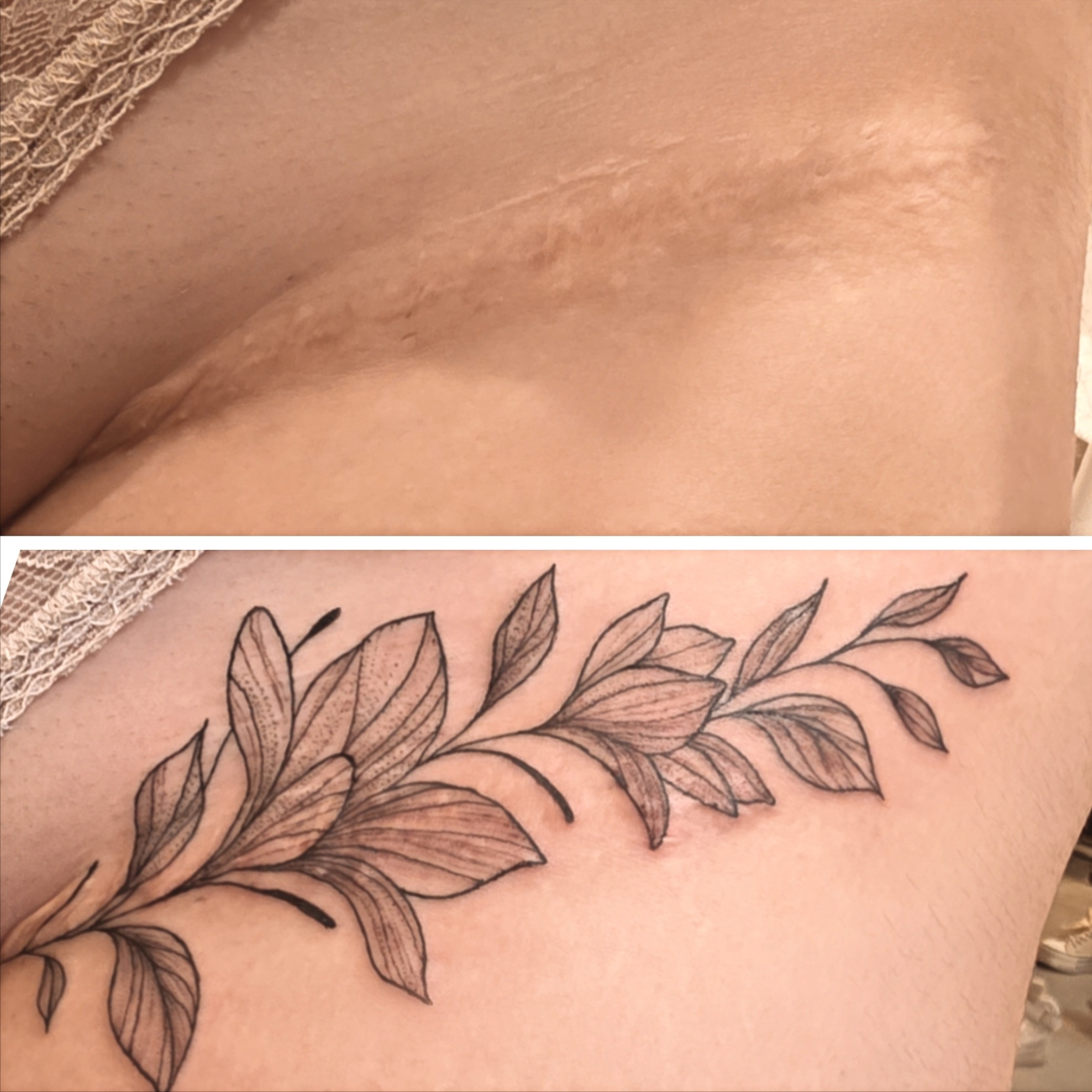 tatouage cancer du sein herault
